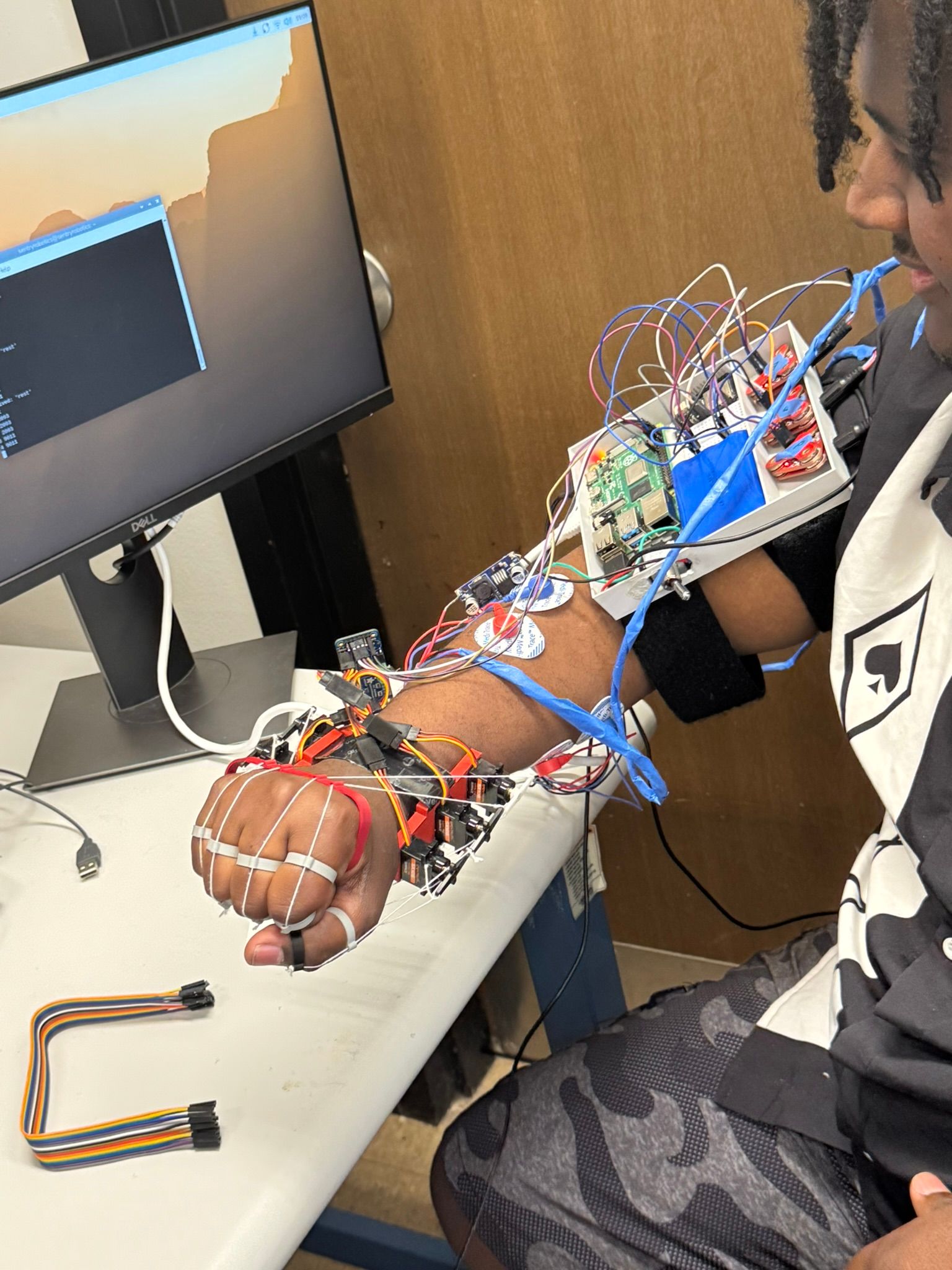 A team member wearing the exoskeleton, with the electronics enclosure strapped to the upper arm and the hand closed in a fist.