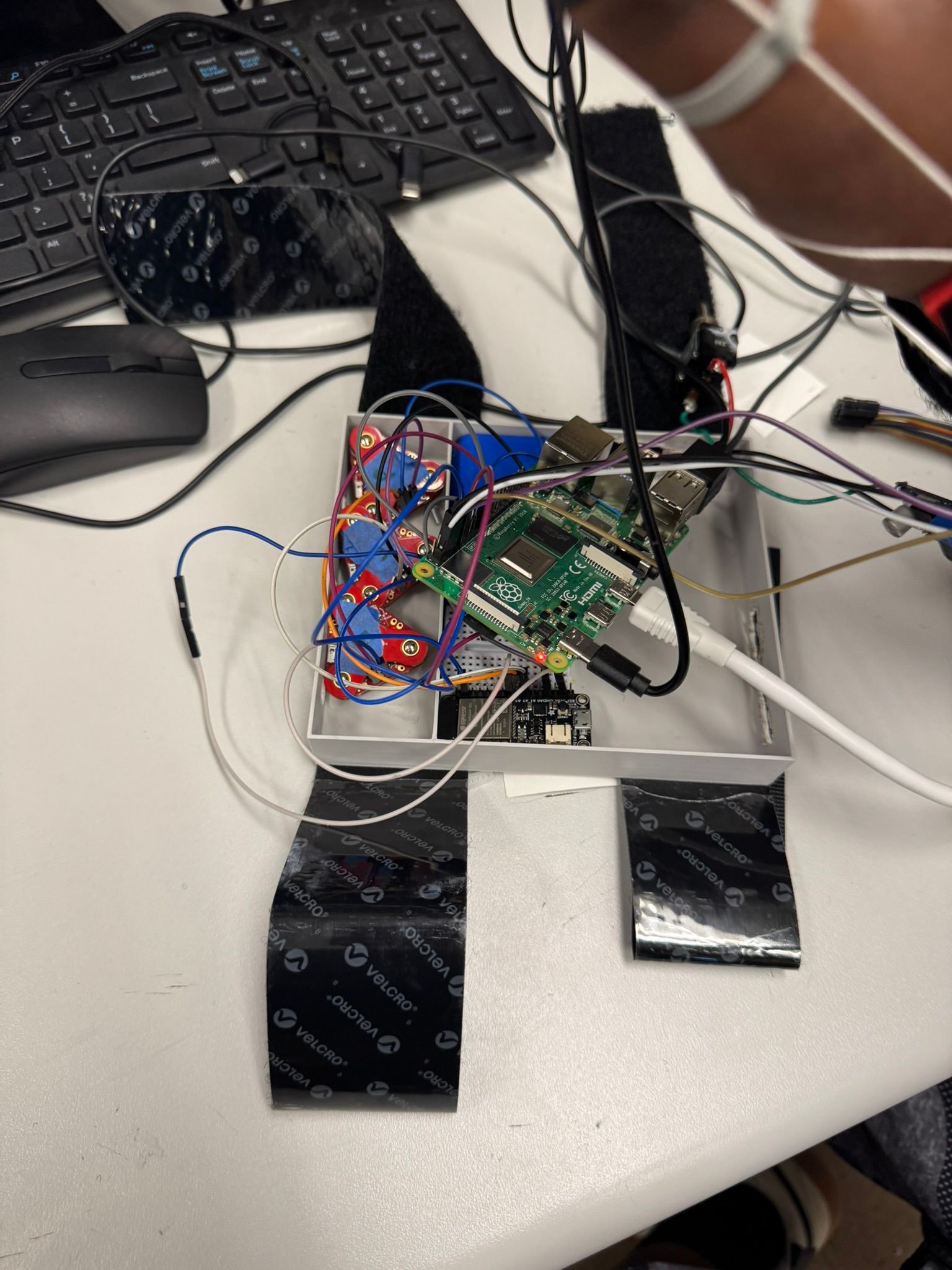 The electronics enclosure, holding a Raspberry Pi, an ESP32 board, and EMG sensor boards, with Velcro straps.